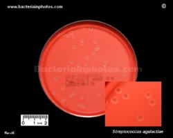 Group B streptococcus